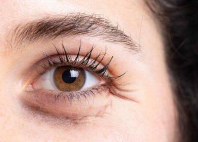 معین سن زیستی با اسکنر چشم